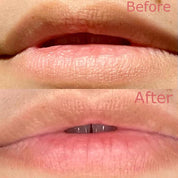 before and after hydrating lip gels smoothing restoring dry cracked lips