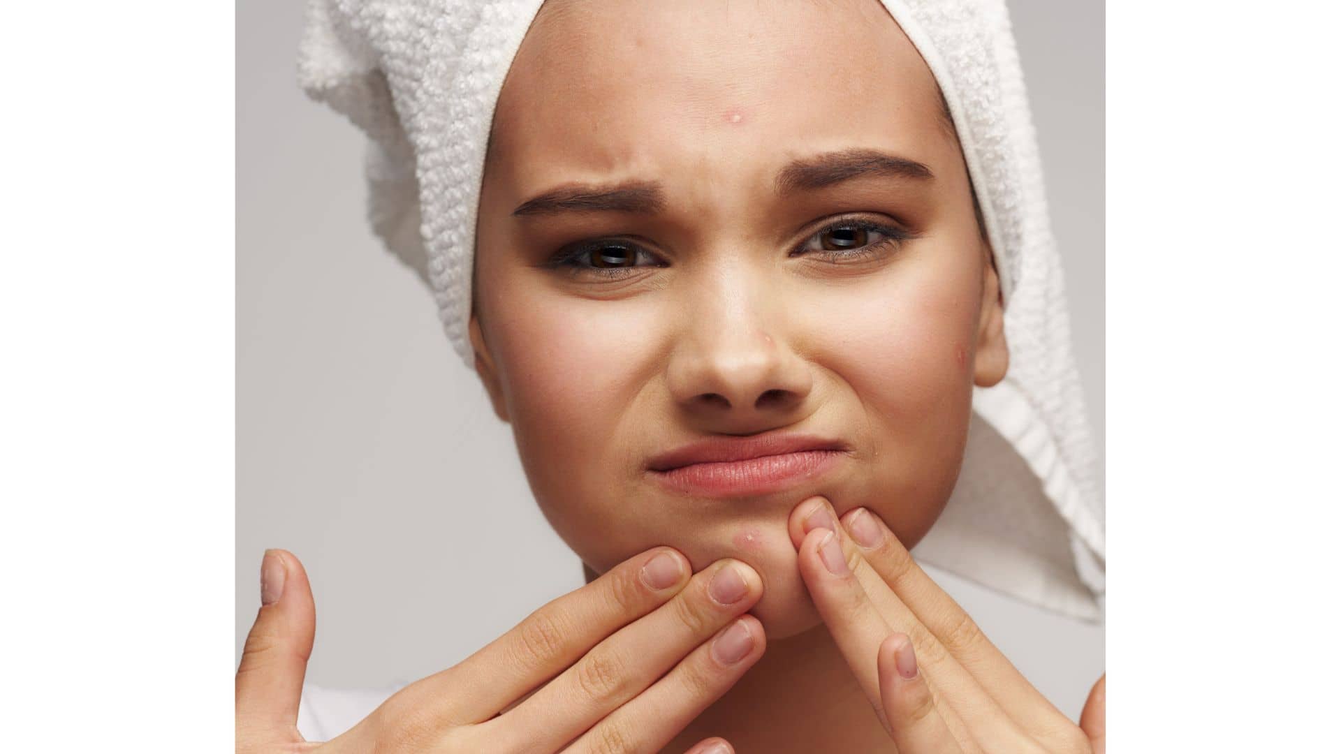 Women with acne pimples skincare to clarify and reduce acne