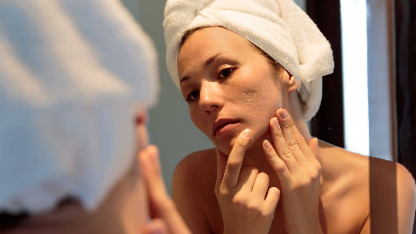 woman acne clearing skincare from patchology