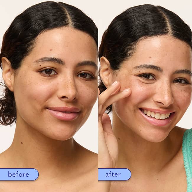 before-and-after-five-to-nine-before-and-after-use-overnight_1.jpg