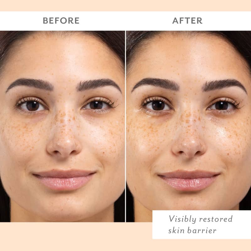 Weekend Skin Reset: Revitalize and Replenish Your Skin – Patchology