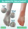 dry cracked heals and blisters