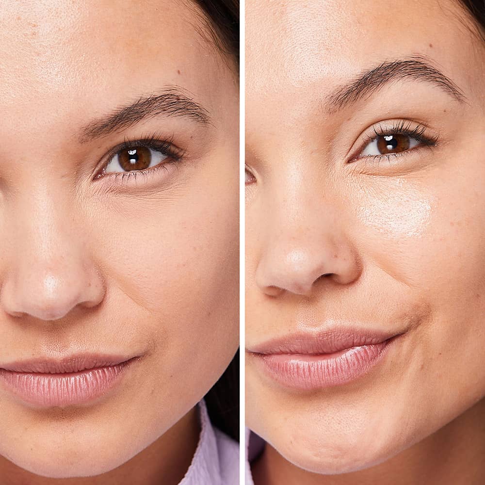 before and after rosé sheet mask showing bright and hydrated skin