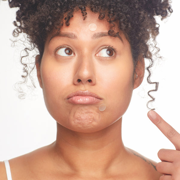 Woman Applying Pimple Patches from Breakout Box to forhead and Chin - Patchology